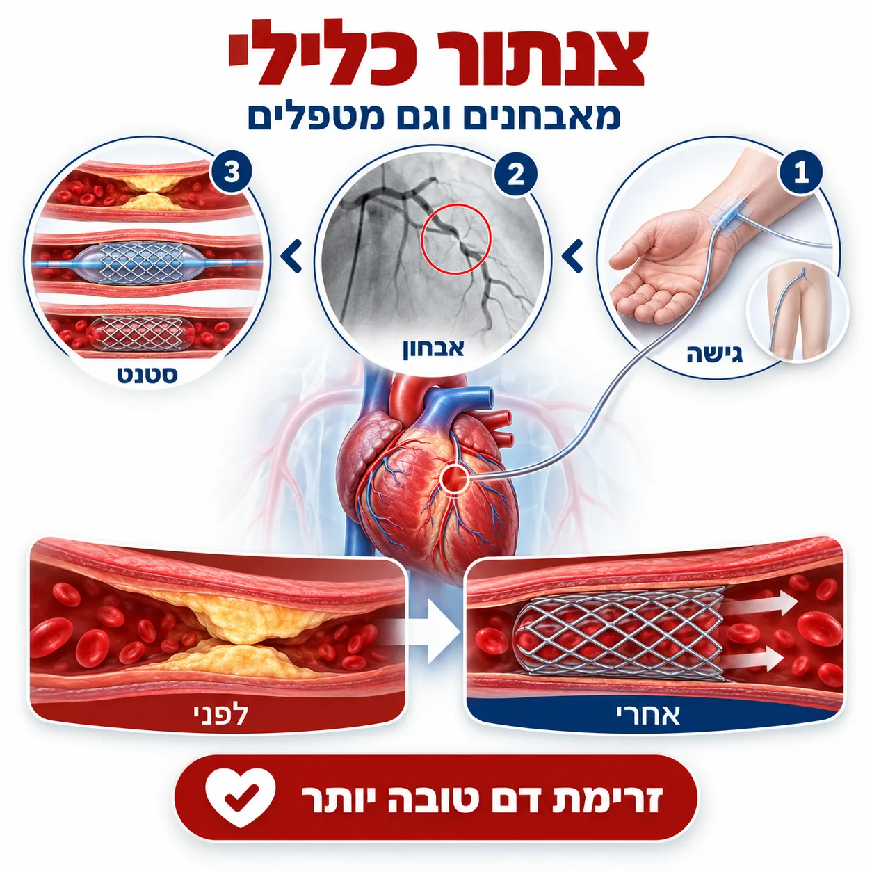 מחלת לב איסכמית | אינפוגרפיקה