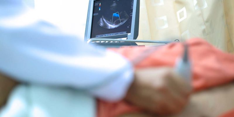 Echocardiogram