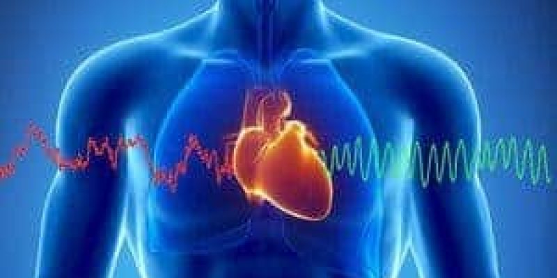 HEART330