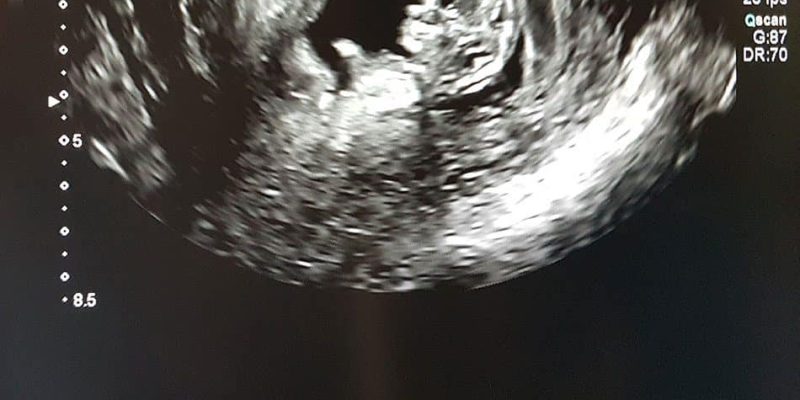 fetal-echo-img-03